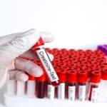 Creatinine Test: A Simple Check for Kidney Health