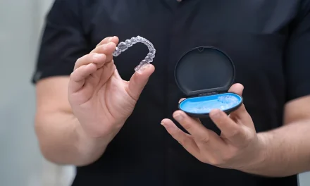 A Few things to Know Before You Start Invisalign